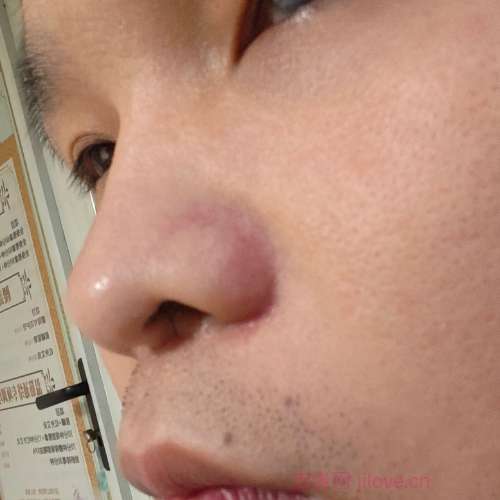 30岁岁江苏单身帅哥 - 滁州吉缘网